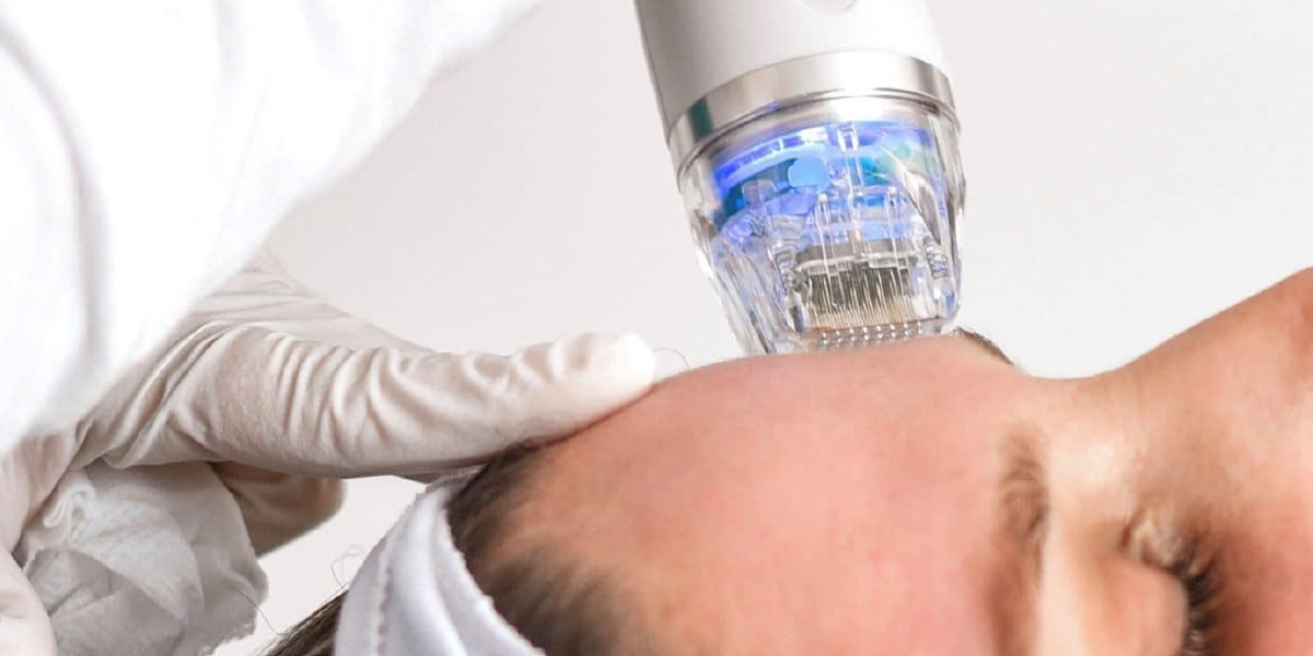 PINXEL-V Microneedling